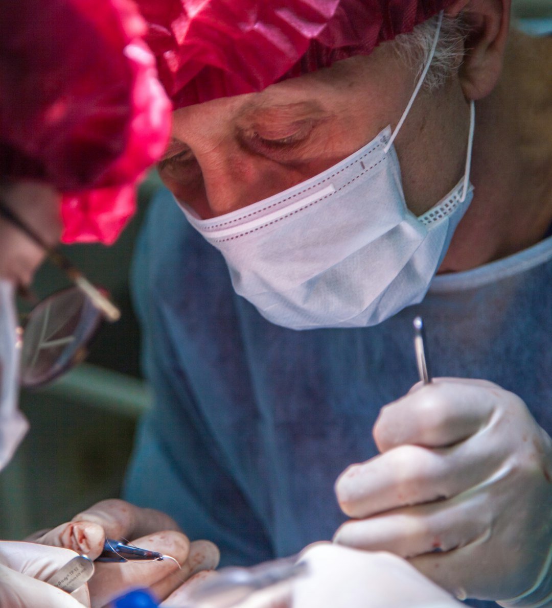 Implantes