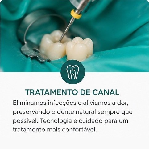 Tratamento de Canal