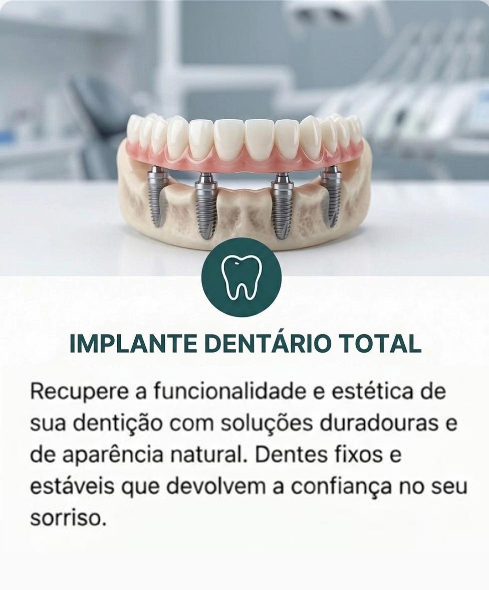Implante Dentário Total